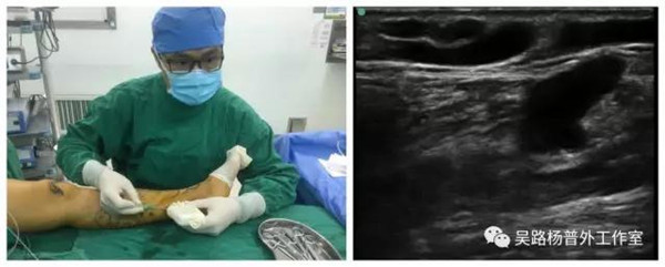 1642585020573993.png 图片7.png