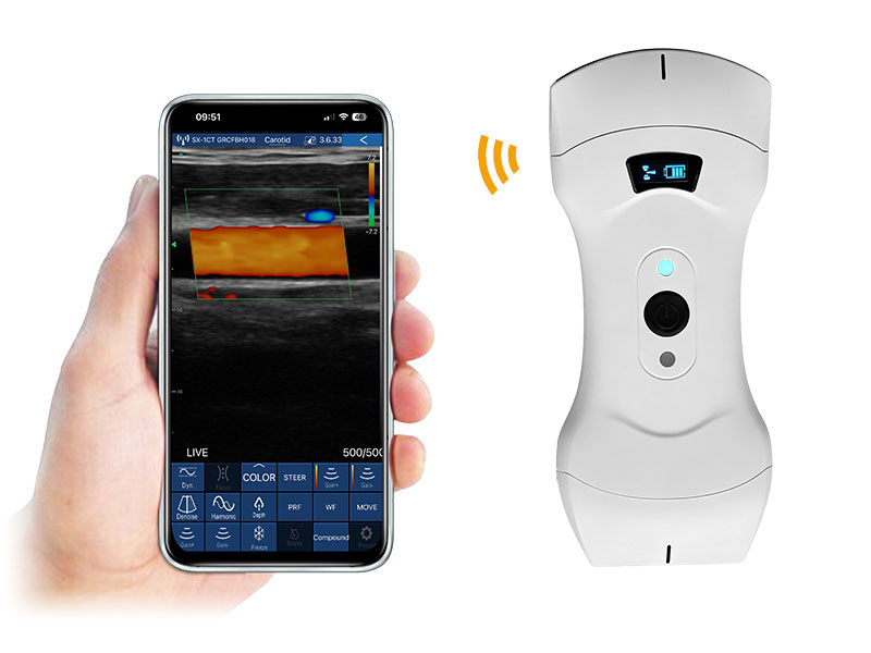 6CPL Plus 3in1 palm doppler ultrasound scanner